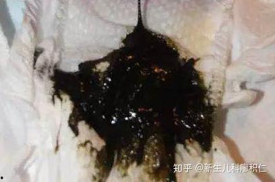 成人拉屎正常吗图片视频,图片视频深度解析